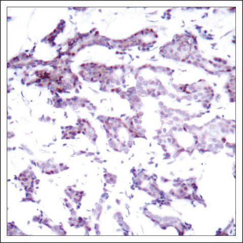 Anti-ELK1 (Ab-389) antibody produced in rabbit