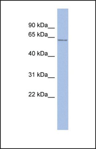 Anti-ENC1, (N-terminal) antibody produced in rabbit