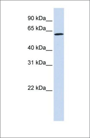 Anti-ENOX1 antibody produced in rabbit