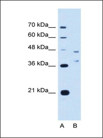 Anti-EVI2B antibody produced in rabbit