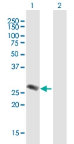 Anti-EVI2A, (C-terminal) antibody produced in mouse