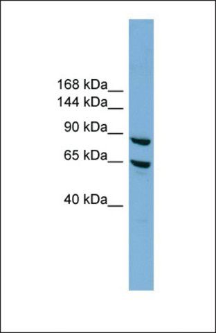 Anti-EXOC6, (N-terminal) antibody produced in rabbit