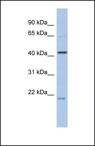 Anti-FAM98B, (N-terminal) antibody produced in rabbit