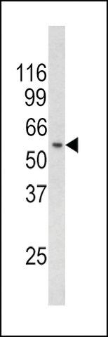 ANTI-CHC1L(N-TERMINAL) antibody produced in rabbit