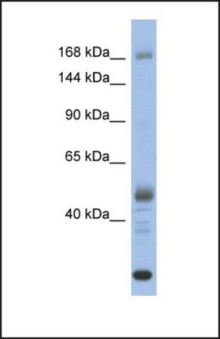 Anti-CHD1 antibody produced in rabbit