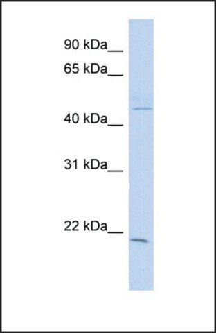 Anti-CIB3, (N-terminal) antibody produced in rabbit