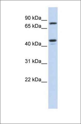 Anti-CHST6 (ab2) antibody produced in rabbit