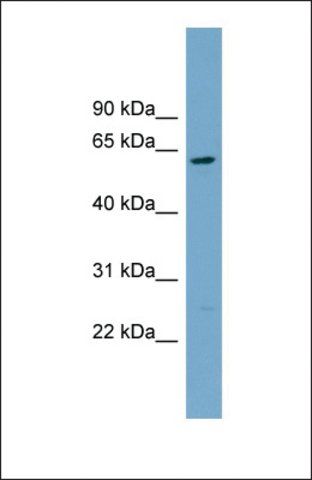 Anti-CNDP2 antibody produced in rabbit