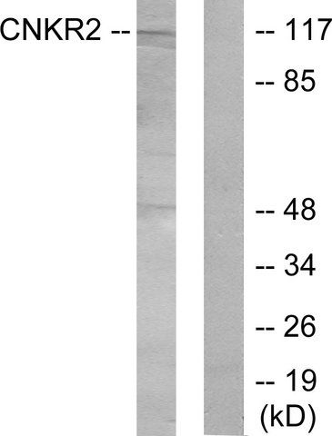 Anti-CNKR2 antibody produced in rabbit