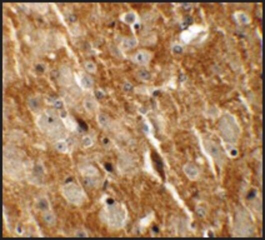 Anti-CTTNBL1 antibody produced in rabbit