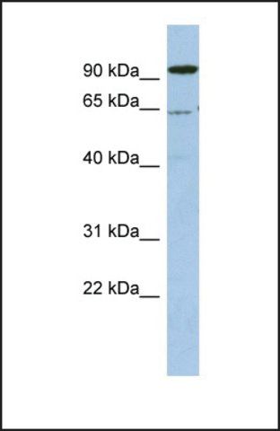 Anti-DDX52, (N-terminal) antibody produced in rabbit