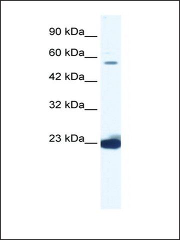 Anti-DDX55 (AB2) antibody produced in rabbit