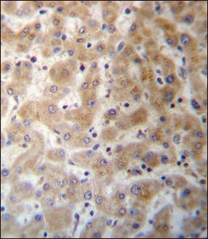 ANTI-DHFRL1 (CENTER) antibody produced in rabbit