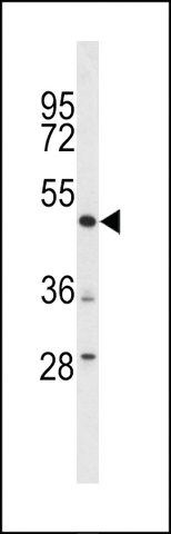 ANTI-DEK(C-TERMINAL) antibody produced in rabbit