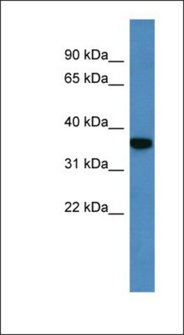 Anti-DECR2 antibody produced in rabbit