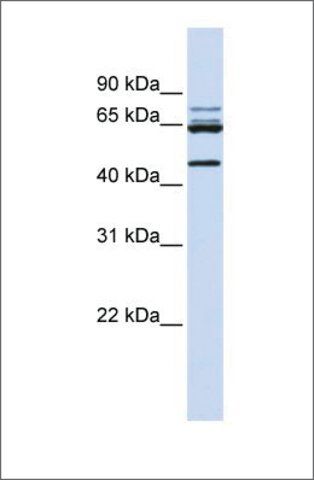 Anti-DDX47 antibody produced in rabbit