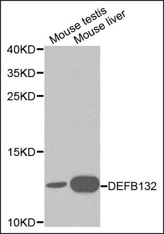 Anti-DEFB132 antibody produced in rabbit