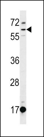 ANTI-DEPDC1B(C-TERMINAL) antibody produced in rabbit