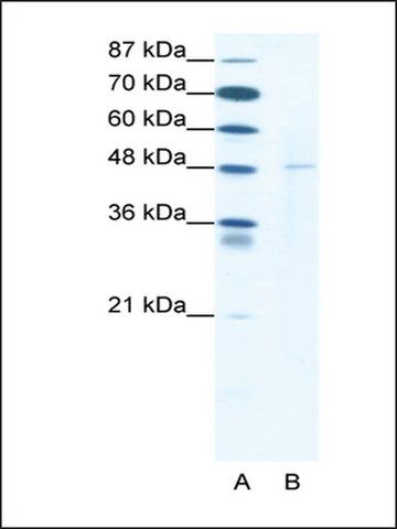 Anti-DEK antibody produced in rabbit