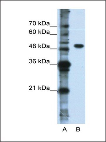 Anti-DDX47 antibody produced in rabbit