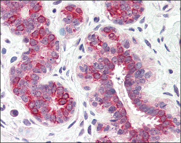 Anti-DHRS7 antibody produced in rabbit