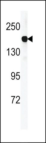 ANTI-DGKK(C-TERMINAL) antibody produced in rabbit