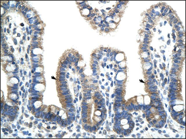 Anti-BTBD6 antibody produced in rabbit