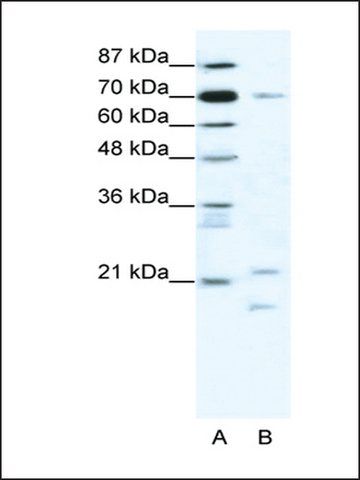 Anti-BTF3 antibody produced in rabbit