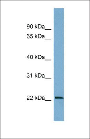 Anti-BTG4 antibody produced in rabbit