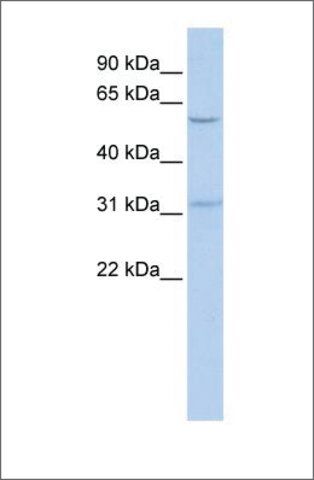 Anti-BTBD14B antibody produced in rabbit