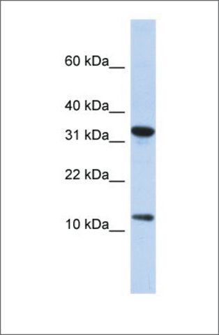 Anti-BTF3L1 antibody produced in rabbit