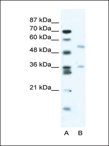 Anti-BTBD3 (AB1) antibody produced in rabbit