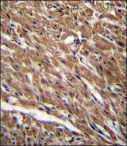 ANTI-BTG3 (CENTER) antibody produced in rabbit