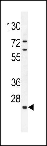 ANTI-C15ORF41 (CENTER) antibody produced in rabbit