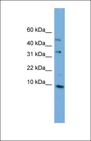 Anti-C16ORF61 antibody produced in rabbit