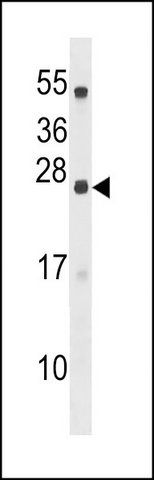 ANTI-C18ORF26 (N-TERM) antibody produced in rabbit