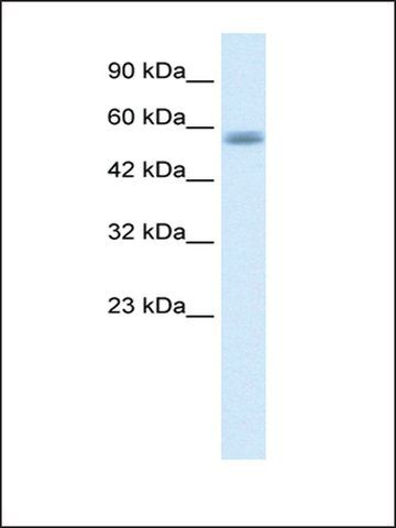 Anti-C16ORF44 antibody produced in rabbit