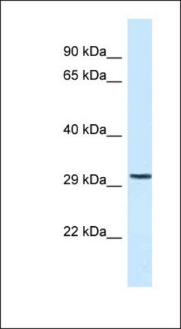 Anti-C18ORF1 antibody produced in rabbit