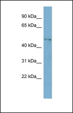 Anti-C1GALT1 antibody produced in rabbit