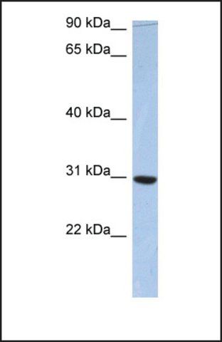 Anti-C16ORF65 antibody produced in rabbit