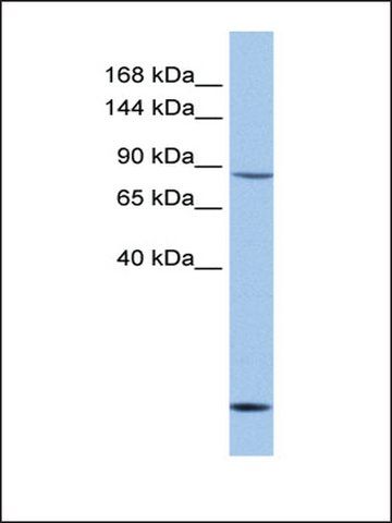 Anti-C1D (AB2) antibody produced in rabbit