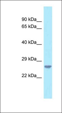 Anti-C18ORF1 antibody produced in rabbit