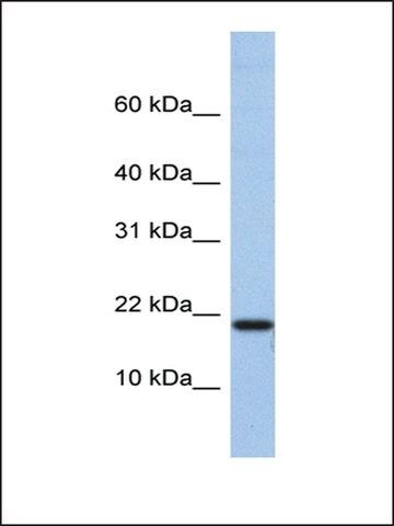 Anti-C1D antibody produced in rabbit