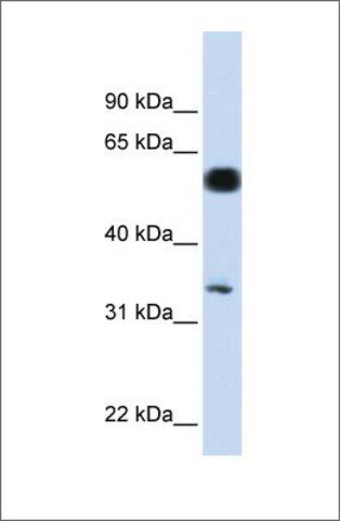 Anti-C19ORF62 antibody produced in rabbit