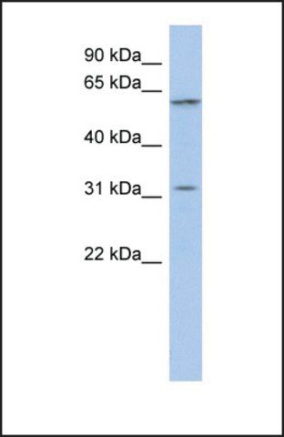 Anti-C1ORF110 antibody produced in rabbit