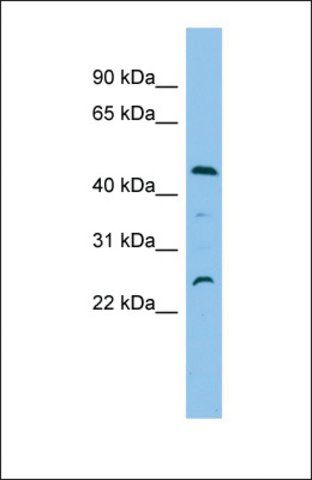 Anti-C1ORF102, (N-terminal) antibody produced in rabbit