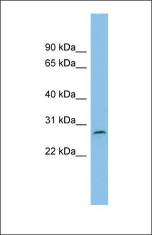 Anti-C1ORF104 antibody produced in rabbit