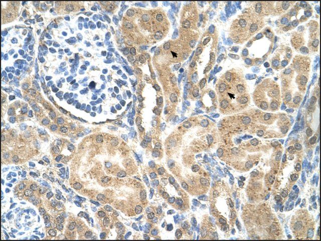 Anti-C19ORF28 antibody produced in rabbit