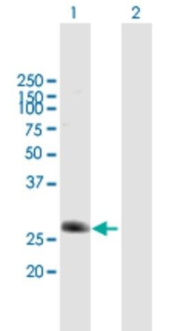 Anti-C5ORF20 antibody produced in mouse