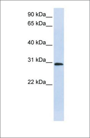 Anti-C6ORF21 antibody produced in rabbit